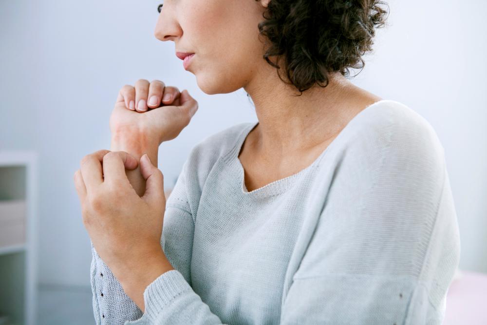 Essential Oils For Psoriasis Management